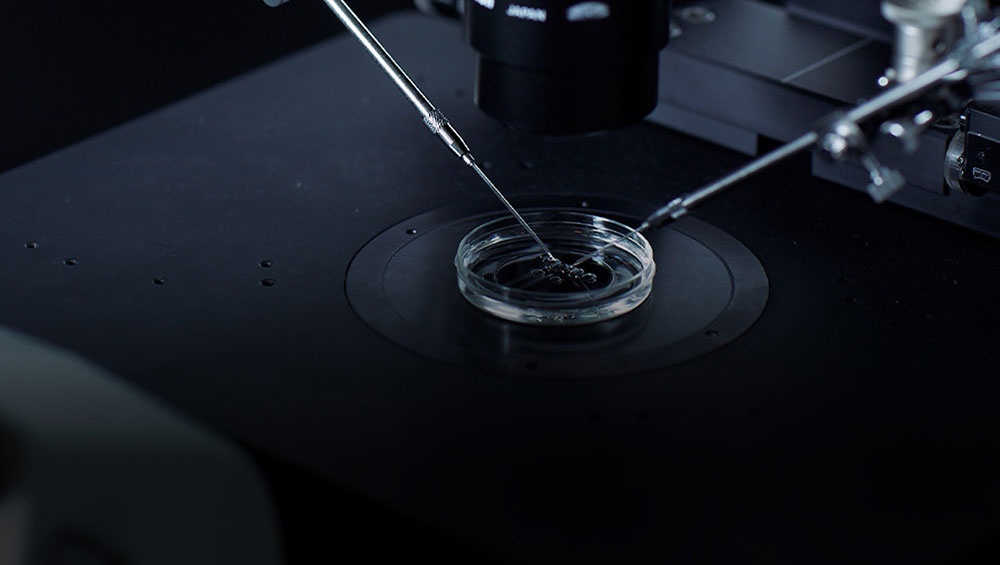 การทำเด็กหลอดแก้วด้วยวิธี IVF ช่วยเพิ่มโอกาสสำเร็จในการมีบุตรของคู่รักที่มีภาวะมีบุตรยาก